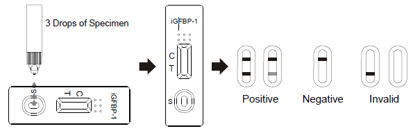 Seitlicher Fluss Immunochromatographic prüft schnelle Test-Kassette AllTest iGFBP-1 im Scheidenausfluss