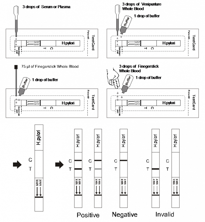 H.pylori-Antikörper-seitlicher Fluss Immunochromatographic prüft Streifen, Vollblut/Serum/Plasma