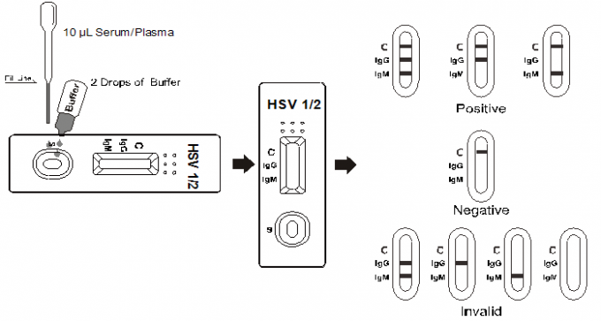 HSV 1/2 IgG/Test-Kassetten-seitlicher Fluss IgM schneller chromatographischer Immunoassay