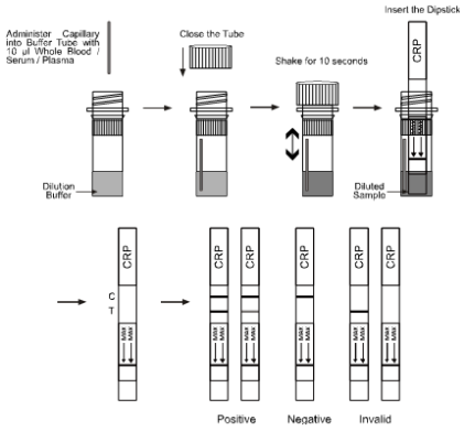 Schneller Test-Ölmessstab-Diagnoseblutproben CRP schneller chromatographischer Immunoassay