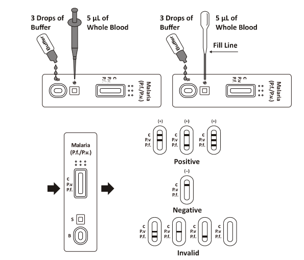 Malaria P.f. /P.v. Schnelle Test-Kassette, schneller Diagnosen-Test