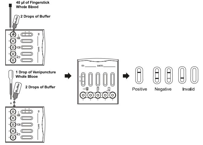 Hohe Empfindlichkeits-multi- Drogen-Test-Kassette mit schneller Lesung (WB/S/P)