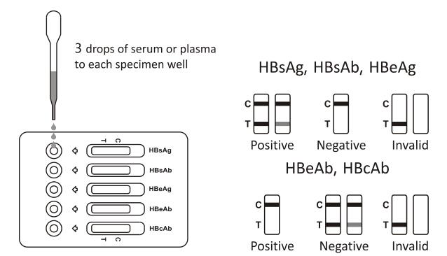 Kombinierte schnelle Test-Kassette HBV (Serum/Plasma) mit HBsAg, HBsAb, HBeAg, HBeAb, HBcAb