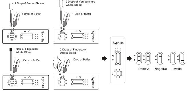 Empfindliche Schritt-Syphilis-schnelle Test-Ausrüstung, Hauptdiagnosen-Prüfungsausrüstungen