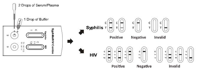 Test-Ausrüstungs-Infektionskrankheit AllTest-Syphilis-/HIV 1.2.O kombinierte schnelle