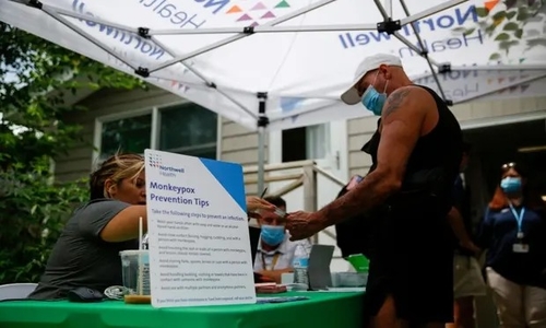 Latest company news about Träge Antwort zu den Monkeypox-Exposés US-Gesundheits-Agenturen, wie „müde, überarbeitet“