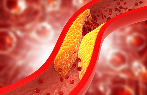 Latest company news about Cholesterin entschlüsseln: Der Weg zu einem gesunden Körper
