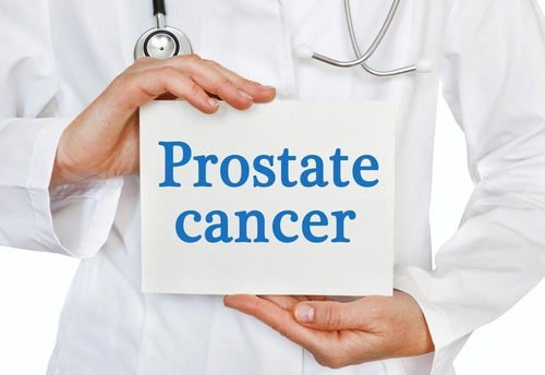 Neueste Unternehmensnachrichten über Prostatakrebs: Weltweit ein wachsendes Gesundheitsproblem für Männer