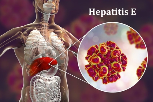 Neueste Unternehmensnachrichten über Virenbedrohung der Fortpflanzung: Die unsichtbaren Gefahren von Hepatitis E