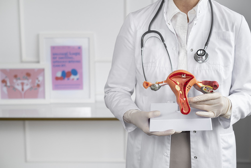 Neueste Unternehmensnachrichten über Endometriose ist stark mit einem erhöhten Risiko für Eierstockkrebs verbunden