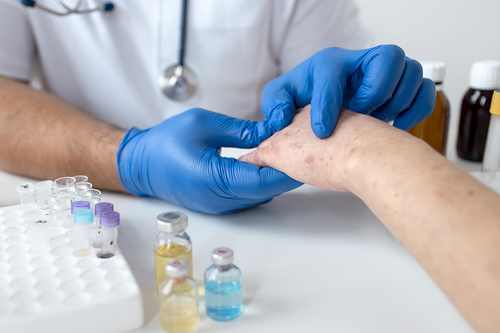 Neueste Unternehmensnachrichten über Mpox: Ein weltweites Gesundheitsproblem