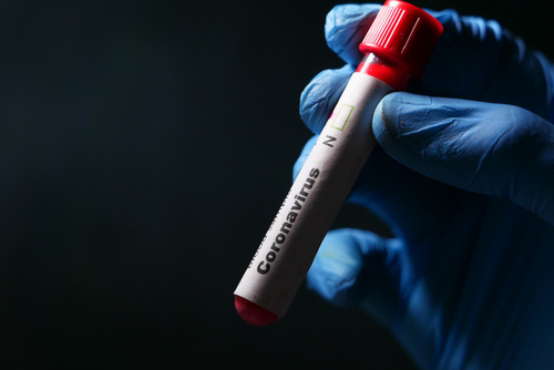 Neueste Unternehmensnachrichten über Schwelle des Zyklus-SARS-CoV-2: Ein metrisches das ist von Bedeutung (oder nicht)